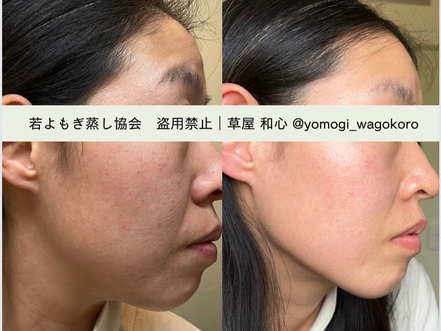 お肌が艶々、くすみ解消お顔が引き締まり!小顔になりました_隠れ家サロン アンシャンテ