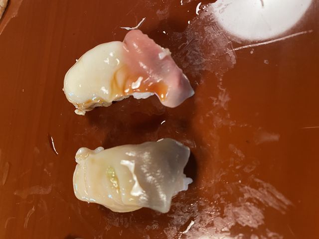 オホーツク海からの宝物_中鮨