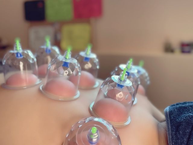 カッピング_愛音セラピーヒーリング