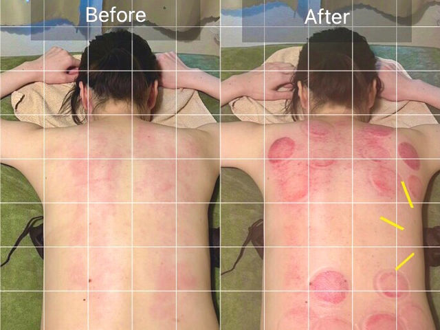 温活専門 わたしのよもぎ蒸し