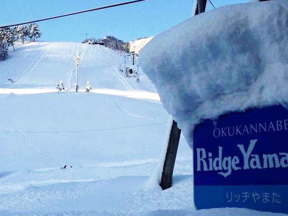 ���b�W��܂��̓Q�����f�̖ڂ̑O�I