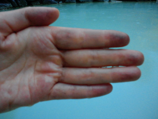 ��������