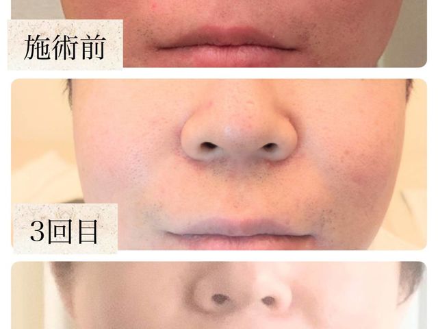 ���N�̂����̔Y�݉�����30��_Herb Spa Eclat ~�G�N��~