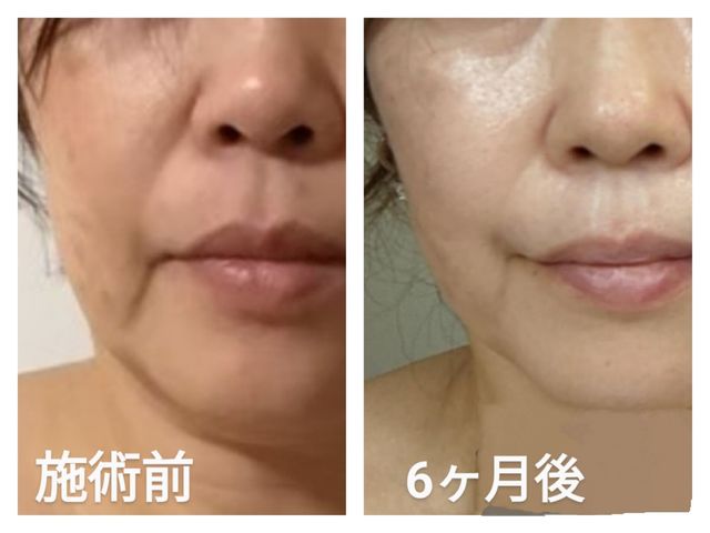 �������Ă������Ȃ������P��50��_Herb Spa Eclat ~�G�N��~