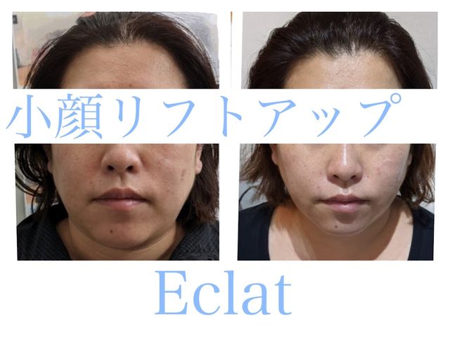 ����̂ނ��݉������������B30��_Herb Spa Eclat ~�G�N��~