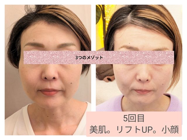 ����݁E������������50��_Herb Spa Eclat ~�G�N��~