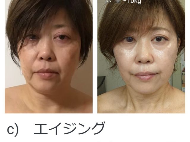 �ʓr�G�C�W���Odeluxe�R�[�X��10�ˎ�Ԃ聚55��_Herb Spa Eclat ~�G�N��~