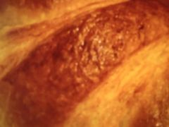 ����������̃o�P�b�g BAQET �V����MIO�X�ւ̓��e�ʐ^1