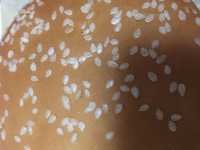 _}Nhih(McDonaldfs) CI[VX