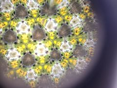 �y�v�V����̈ɓ��K���X�A�[�g�@�郖��̌������ւ̓��e�ʐ^1